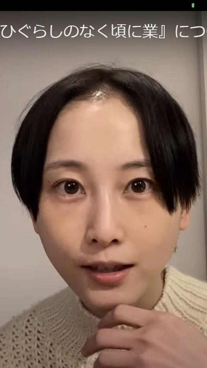 あの可愛かった松井玲奈ちゃんがハゲまくっててショックすぎるwwwwwwwwwwwwwww あの可愛かった松井玲奈ちゃんがハゲまくっててショックすぎるwwwwwwwwwwwwwww