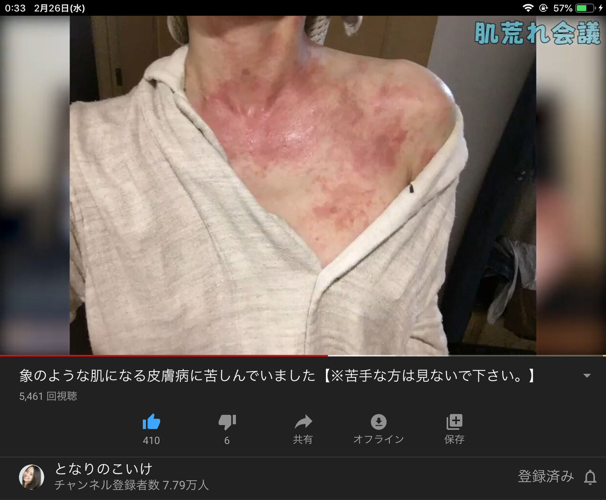 画像 女優 小池里奈 27 の放送事故ギリギリの衝撃配信がコチラｗｗｗｗｗｗｗｗｗｗｗｗｗｗｗ