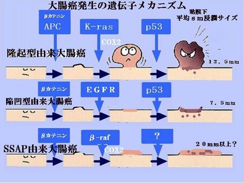 大腸癌発生遺伝子メカニズム