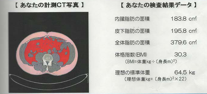 内臓脂肪1