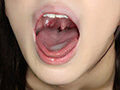 miaa00505-10