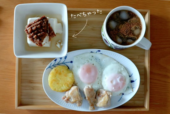 大腸鏡検査を受けるもんで…