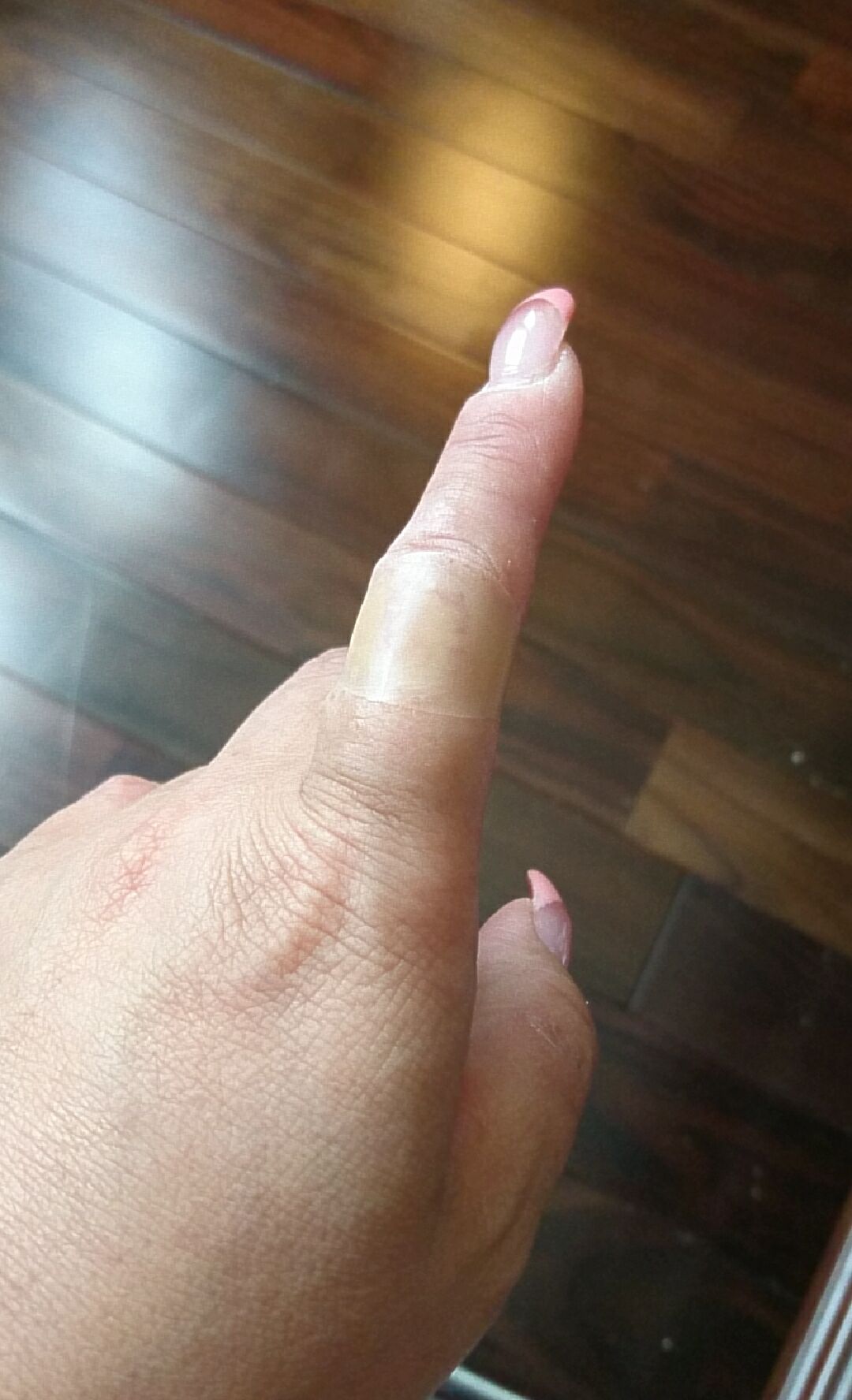 指の怪我 たかはし美容室のブログ