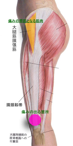 腸 脛 靭帯 腸脛靭帯の解剖学的特徴と役割 腸 脛 靭帯 腸脛靭帯の解剖学的特徴と役割