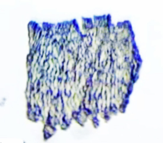 coronavirusvaccine57_04
