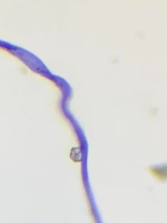 M1