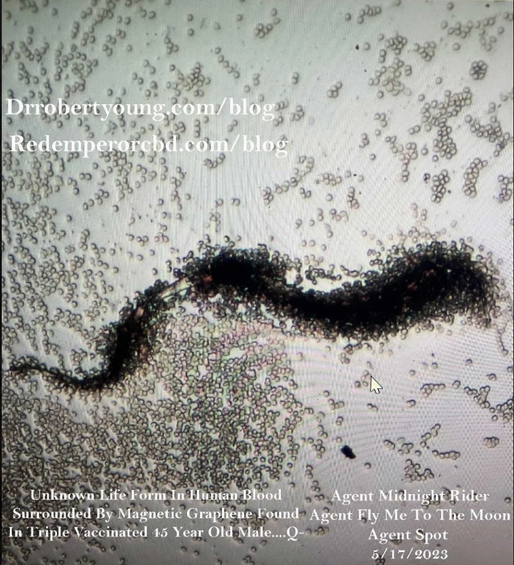 Parasit Trypanosoma cruzi