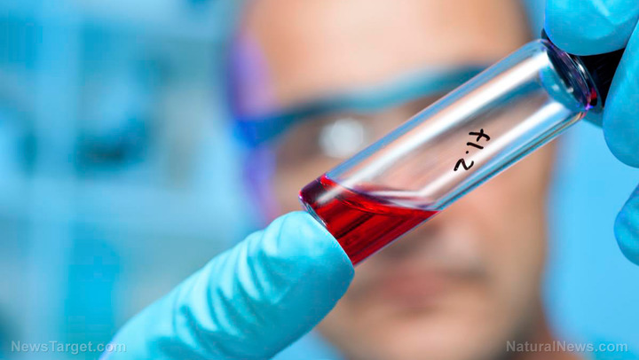 Science-Lab-Sample-Blood-Test__1_