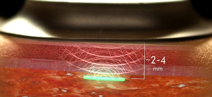 Hydrogel-Biosensor