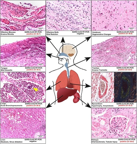 postmortem-tissue-images