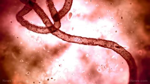 Ebola-Stamm-Virus-Pandemie-Mikroskop_14