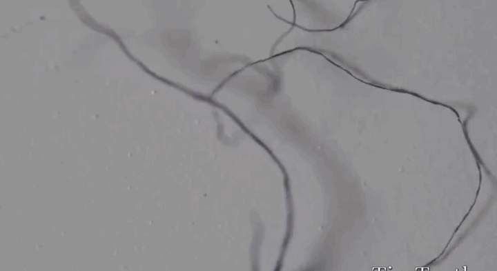 mask-fibers-3