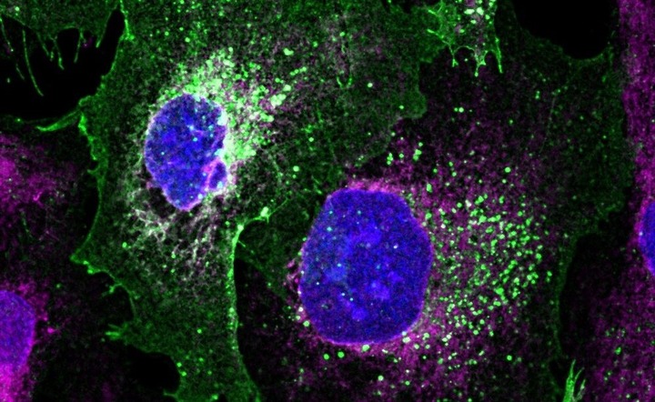 University-of-Bristol_Podocytes-Repaired