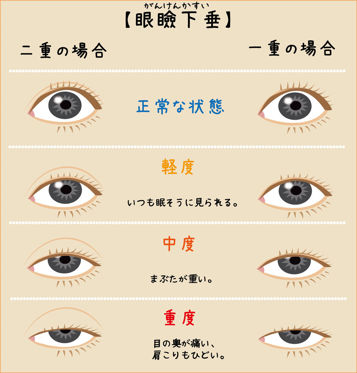 爺ちゃん眼瞼下垂治療レポート イタチのココちゃんと爺ちゃんの薬箱