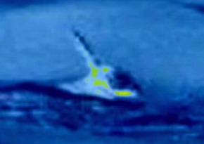 Effectplus_20160131_055702