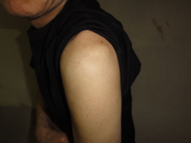 コロナワクチン接種後の経過 その２ 映画 海辺の家族たち 竜暗雑記帳