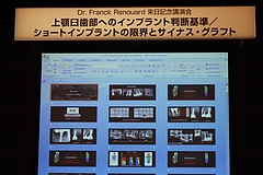 フランク・レノワー先生特別講演会 番外編