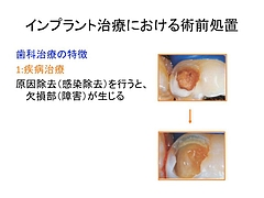 歯科治療の特徴:疾病治療と再建治療 3