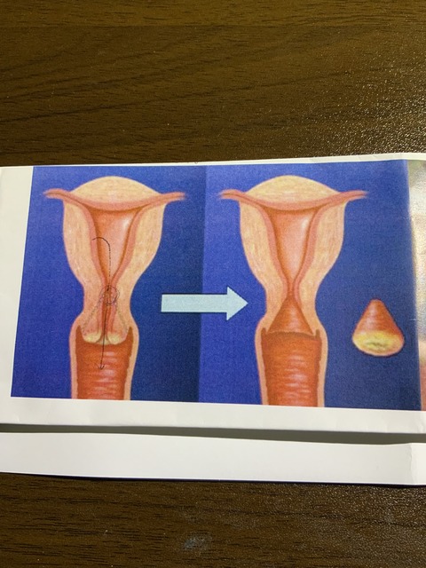 621F1BB1-5293-4BD4-AC90-EFA25CB4E6DE