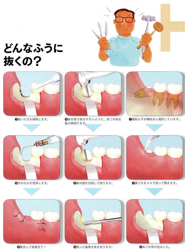 親知らず