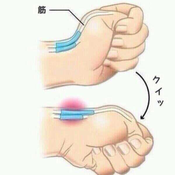 痛い人はスマホとかパソコン触りすぎ