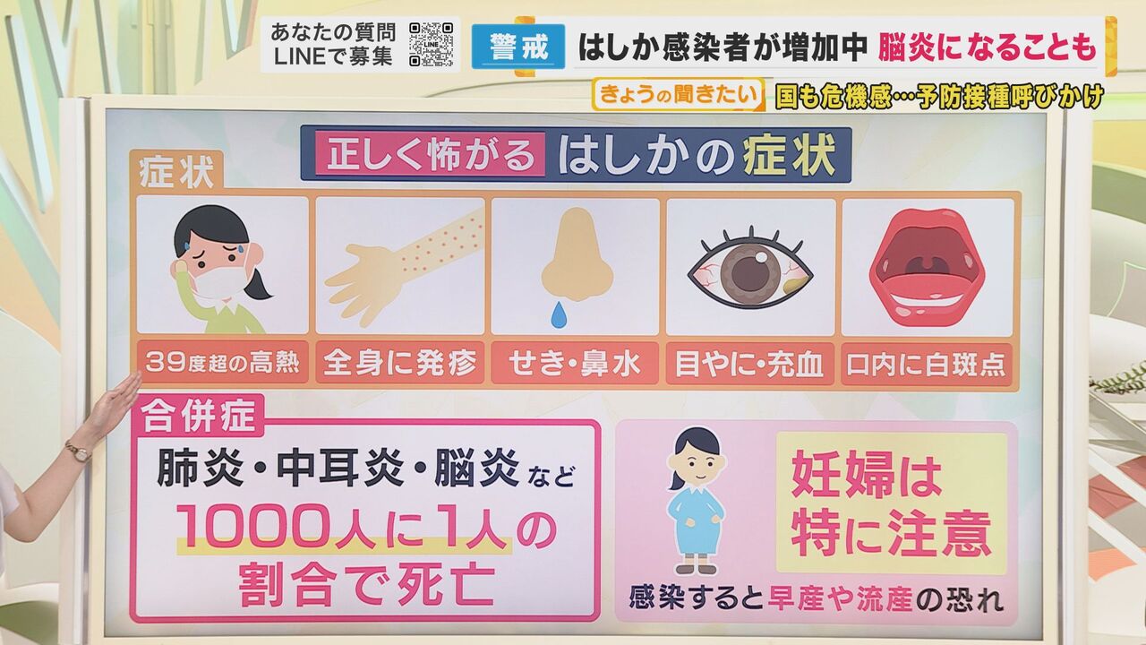 【はしか感染】名古屋市の20代の女性2人が感染 岐阜県でも50代女性が感染 : たこわさニュース速報