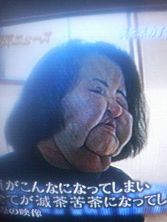 整形依存症 Arikaの モンモン 妄想 広場ぁ V