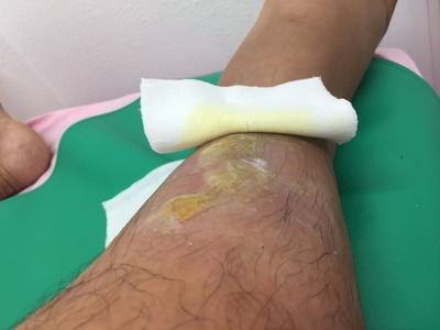 191840fb77adc1f3d7d44780438cfef8