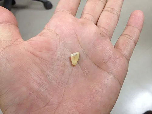 ̾��̤���� 1