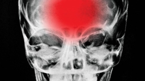 brain-990x557