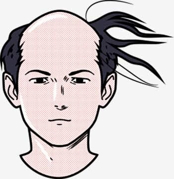 ハゲ、年収400万、35歳、実家暮らし」←婚活パーティ行ったらどうなる 