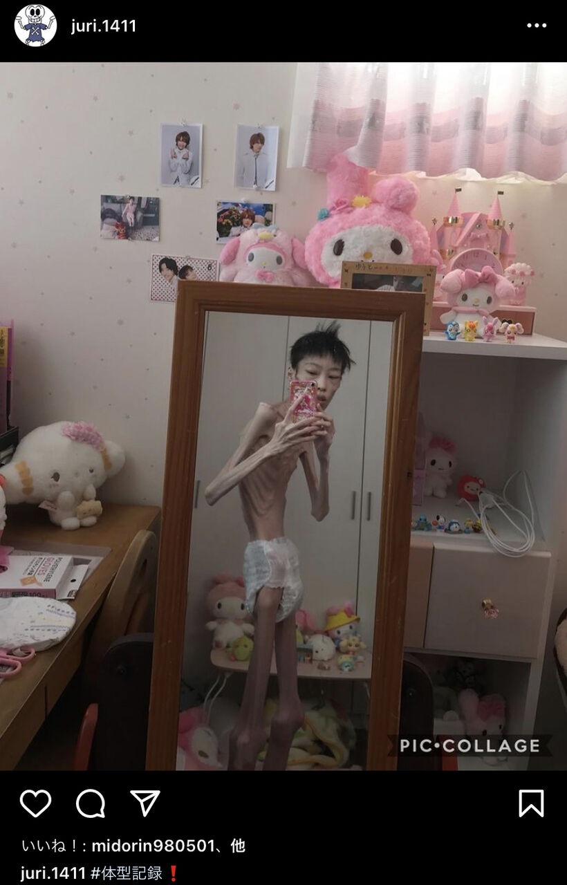 閲覧注意 とんでもない拒食症のアカウントが発見されてしまう 黄昏ちゃんねる 閲覧注意 とんでもない拒食症のアカウントが発見されてしまう 黄昏ちゃんねる