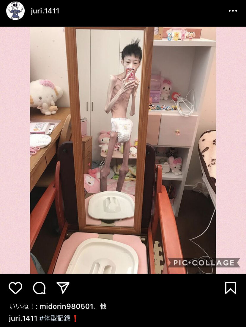 閲覧注意 とんでもない拒食症のアカウントが発見されてしまう 黄昏ちゃんねる 閲覧注意 とんでもない拒食症のアカウントが発見されてしまう 黄昏ちゃんねる