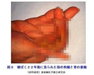 HounRLxFFdP9AA81626326766_1626326784