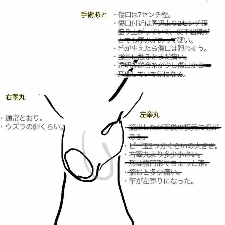 術後の経過状況 Ankuplog