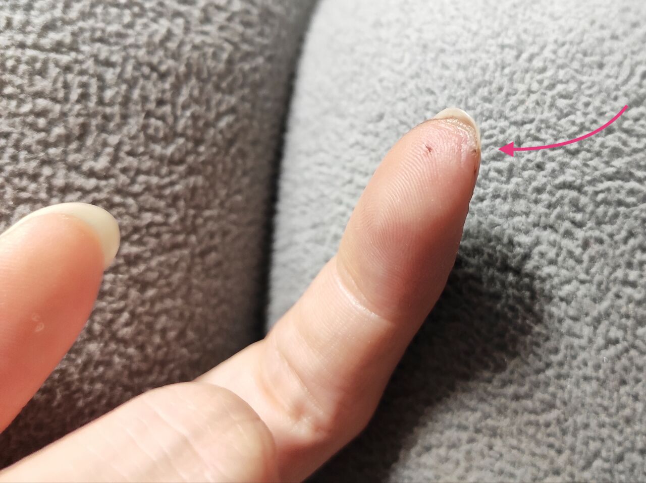 レントゲン写真あり 隠された真実 実録主義