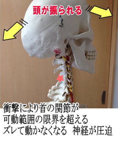 syougeki2