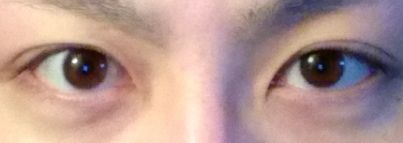 片目だけ二重のやつwowowowowowowowowowowow それな速報