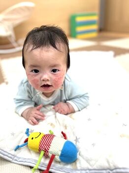 0417②