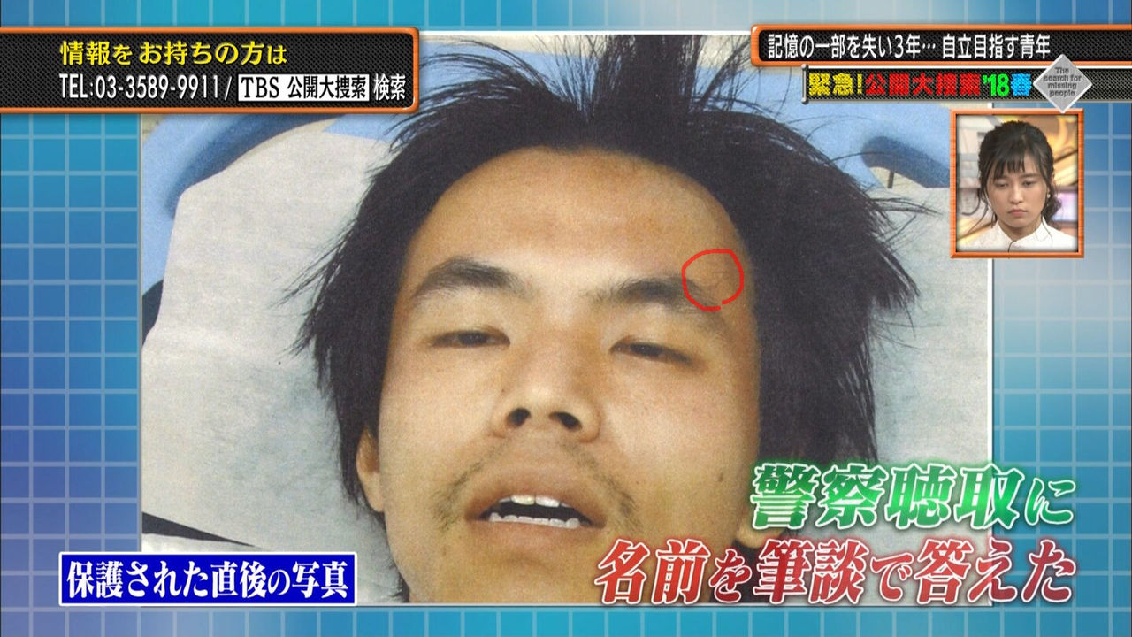 徳島県警 29年前に行方不明の松岡伸矢ちゃんの可能性 Tbs公開大捜索に出演の17年間軟禁され記憶がない男性をdna鑑定へ 25ちゃんねるまとめブログ 徳島県警 29年前に行方不明の松岡伸矢ちゃんの可能性 Tbs公開大捜索に出演の17年間軟禁され記憶がない男性をdna鑑定へ 25ちゃんねるまとめブログ