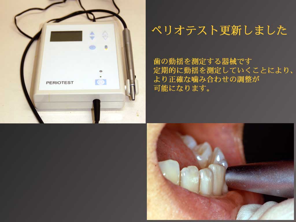 ペリオテストM - 東京歯科産業株式会社 - 健康/医学 ペリオテストM - 東京歯科産業株式会社 - 健康/医学