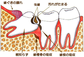 oyasirazu-img