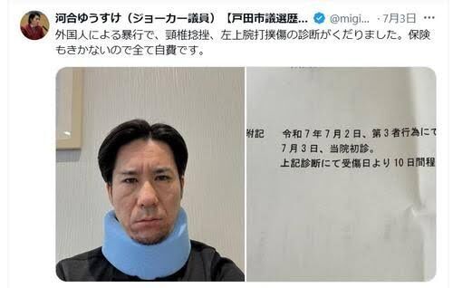 戸田市議が外国人の立ちションを注意 → 殴られて頸椎捻挫と左上腕打撲傷
