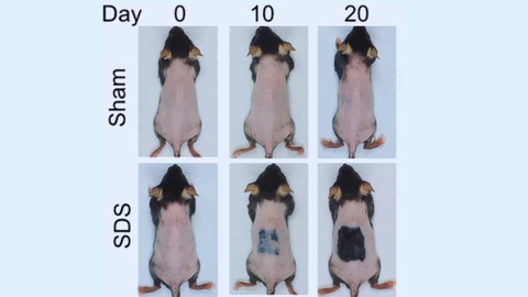オリーブオイルを塗った皮膚、死滅した毛包幹細胞が再生、STAP細胞発見か