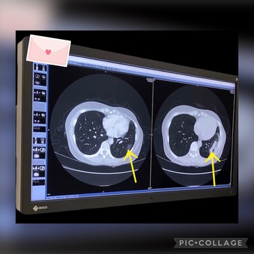 79095C9E-DE62-4C96-9E2A-71F46DD60B2E