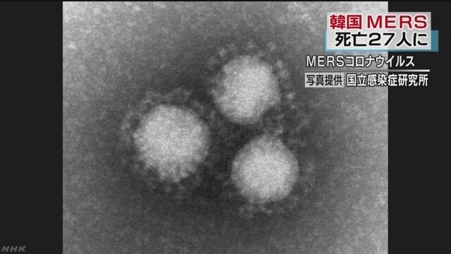 K10010123031_1506221010_1506221012_01_03