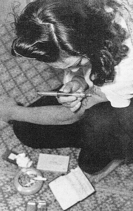 Philopon_dependent_patient_in_1950s