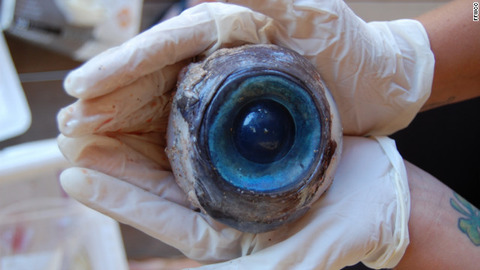 giant-eyeball
