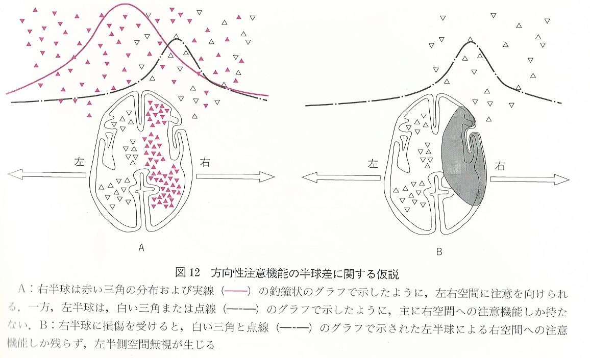 半側空間無視とは Keep On Thinking