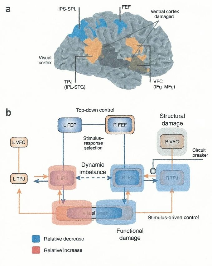 半側空間無視の病態神経学 前頭 頭頂葉ネットワークの機能結合の破綻 Keep On Thinking